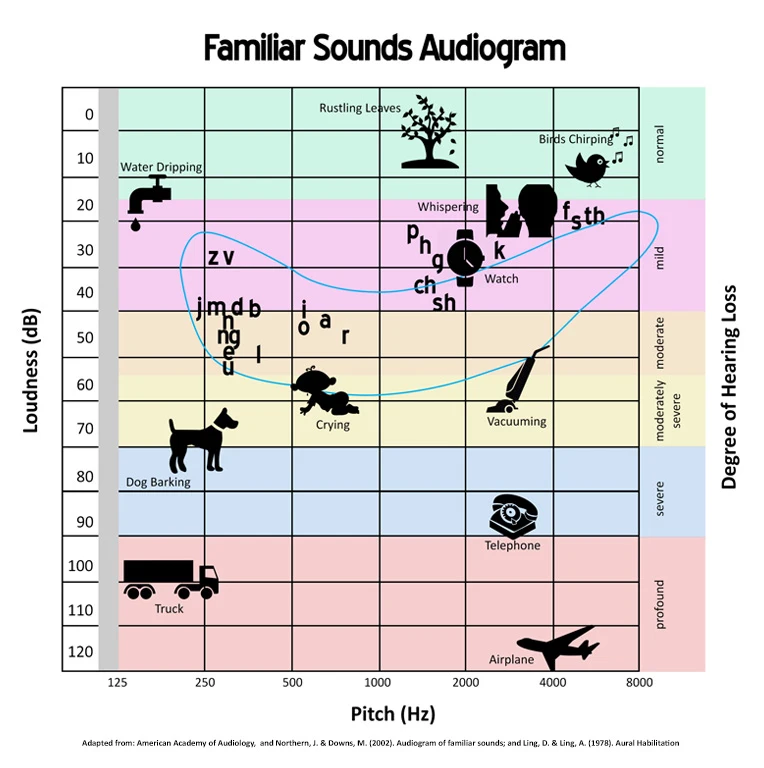 Hearing Loss and Prevention Waukesha WI Audiogram